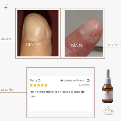 Aceite Antihongos para PIES -  30ml.