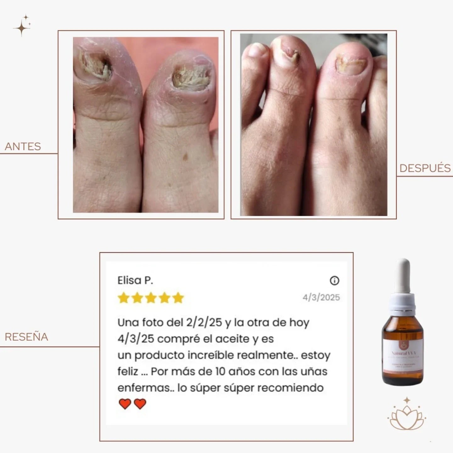 Aceite Antihongos para PIES -  30ml.